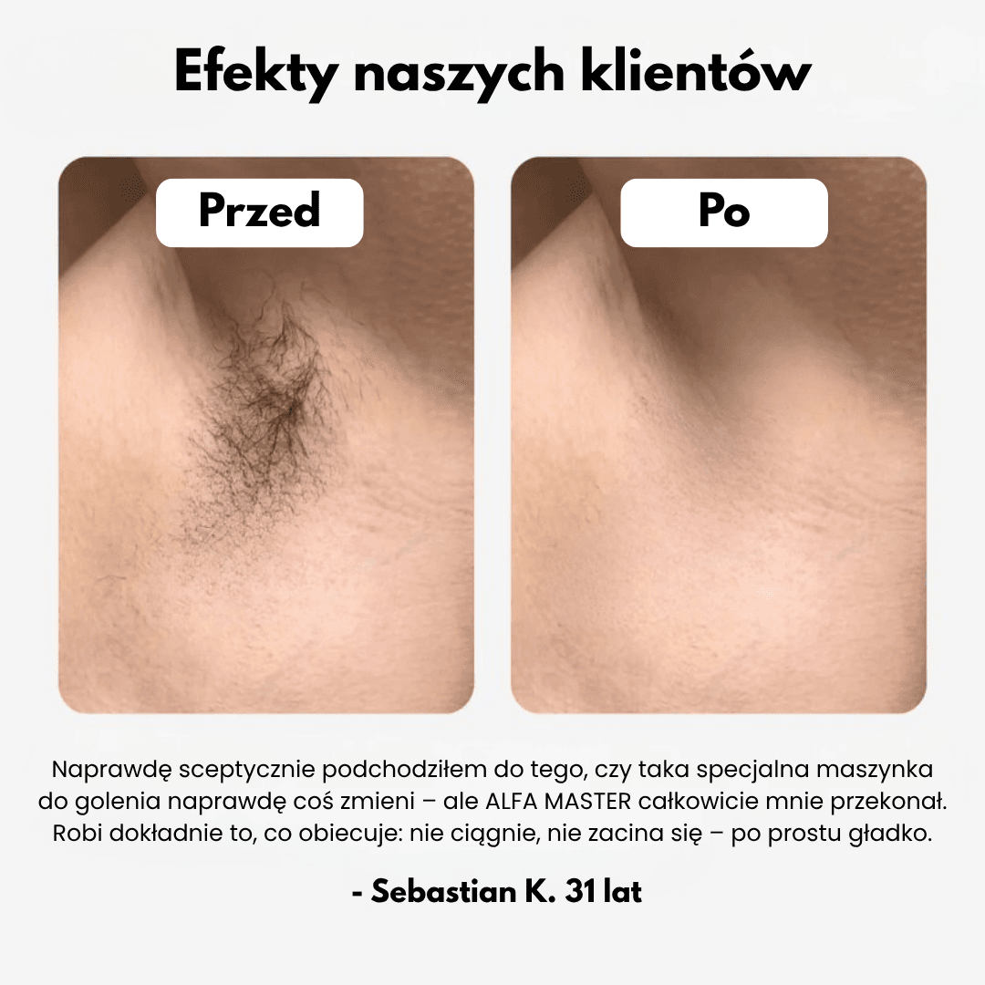 Alfa Master - Maszynka z technologią CutFree®
