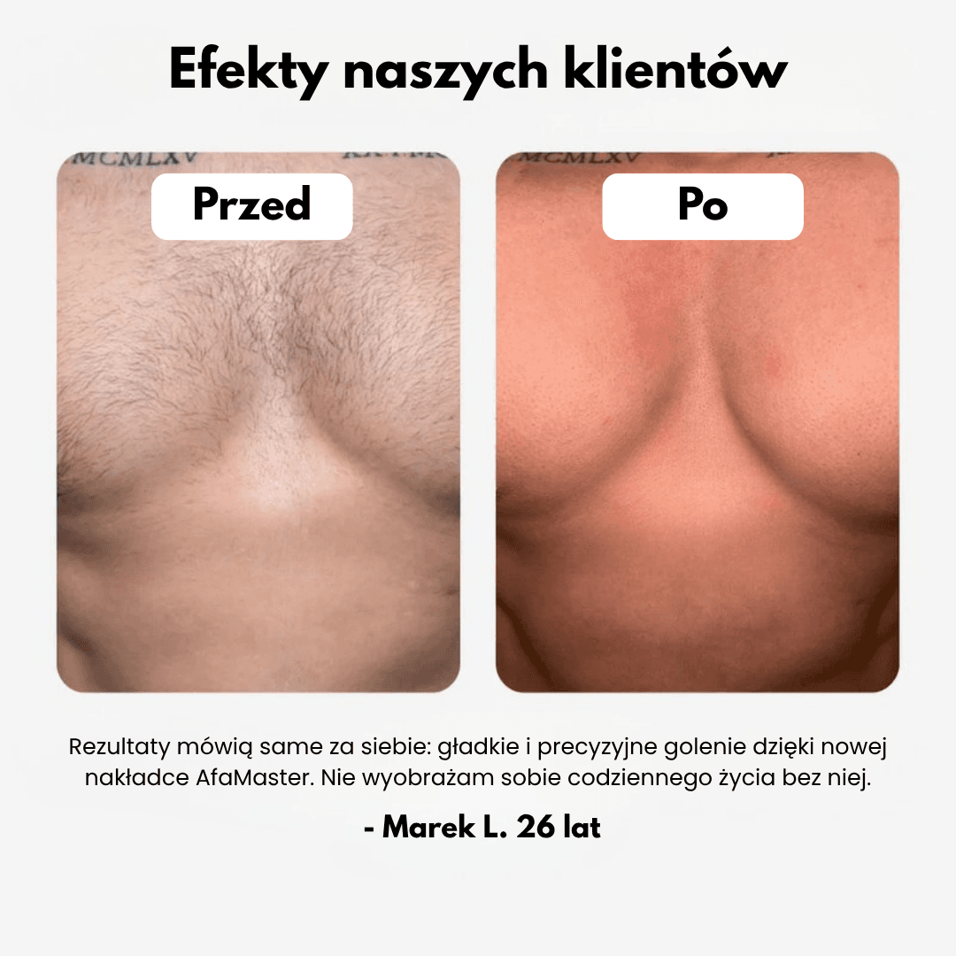 Alfa Master - Maszynka z technologią CutFree®